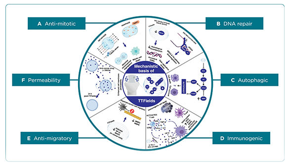Tumor Treating Fields: An Innovative Therapy for Glioblastoma and Other Solid Tumors